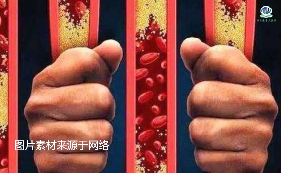 不想给血管“添堵”，尽量少吃以下这些东西，或许能让脑梗离远些  